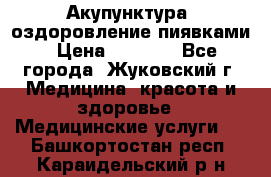 Акупунктура, оздоровление пиявками › Цена ­ 3 000 - Все города, Жуковский г. Медицина, красота и здоровье » Медицинские услуги   . Башкортостан респ.,Караидельский р-н